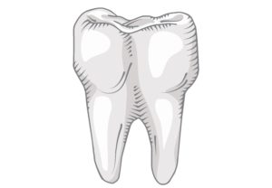 Štancēts metāla zoba kronis